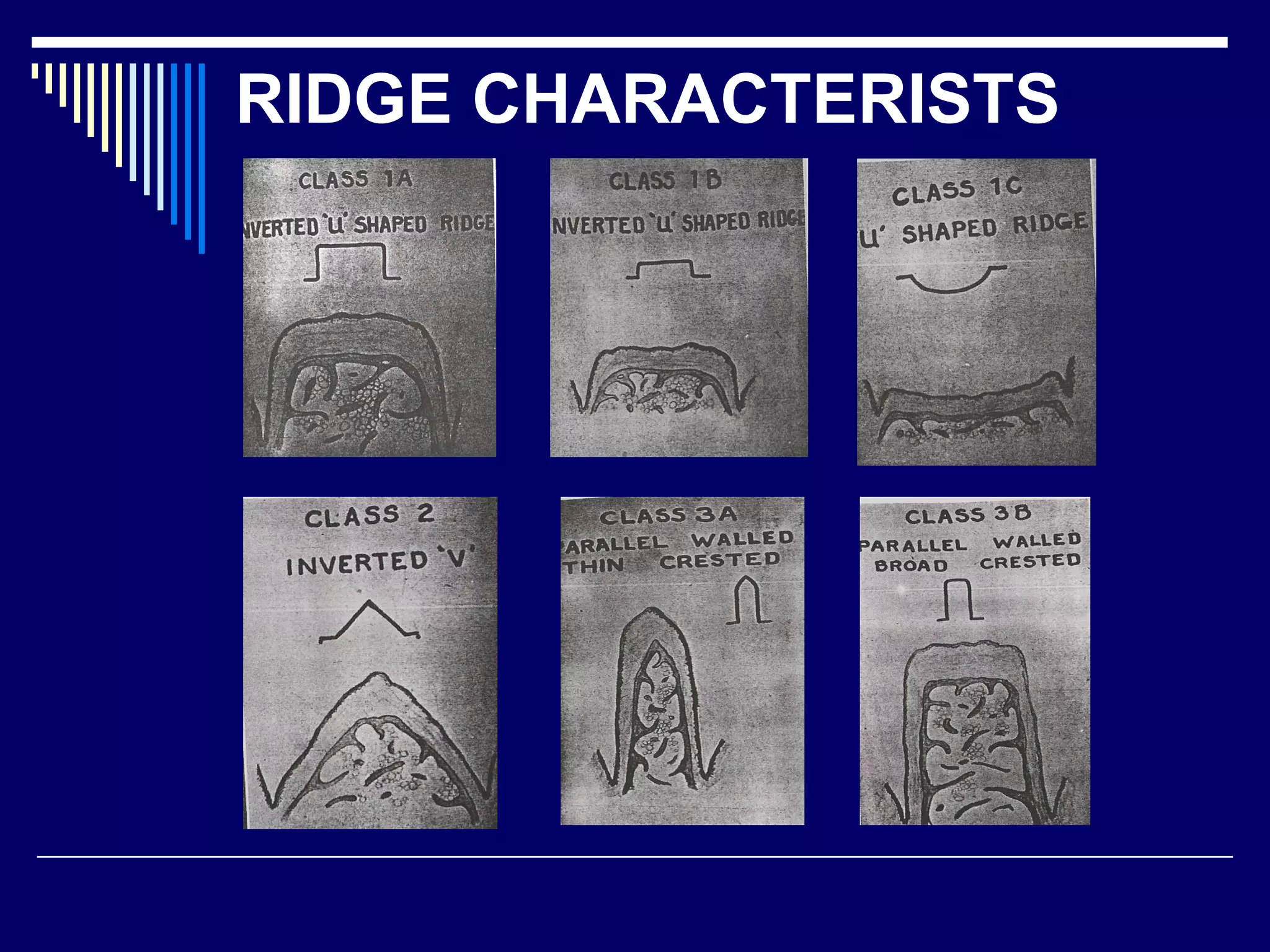 RIDGE CHARACTERISTS
 