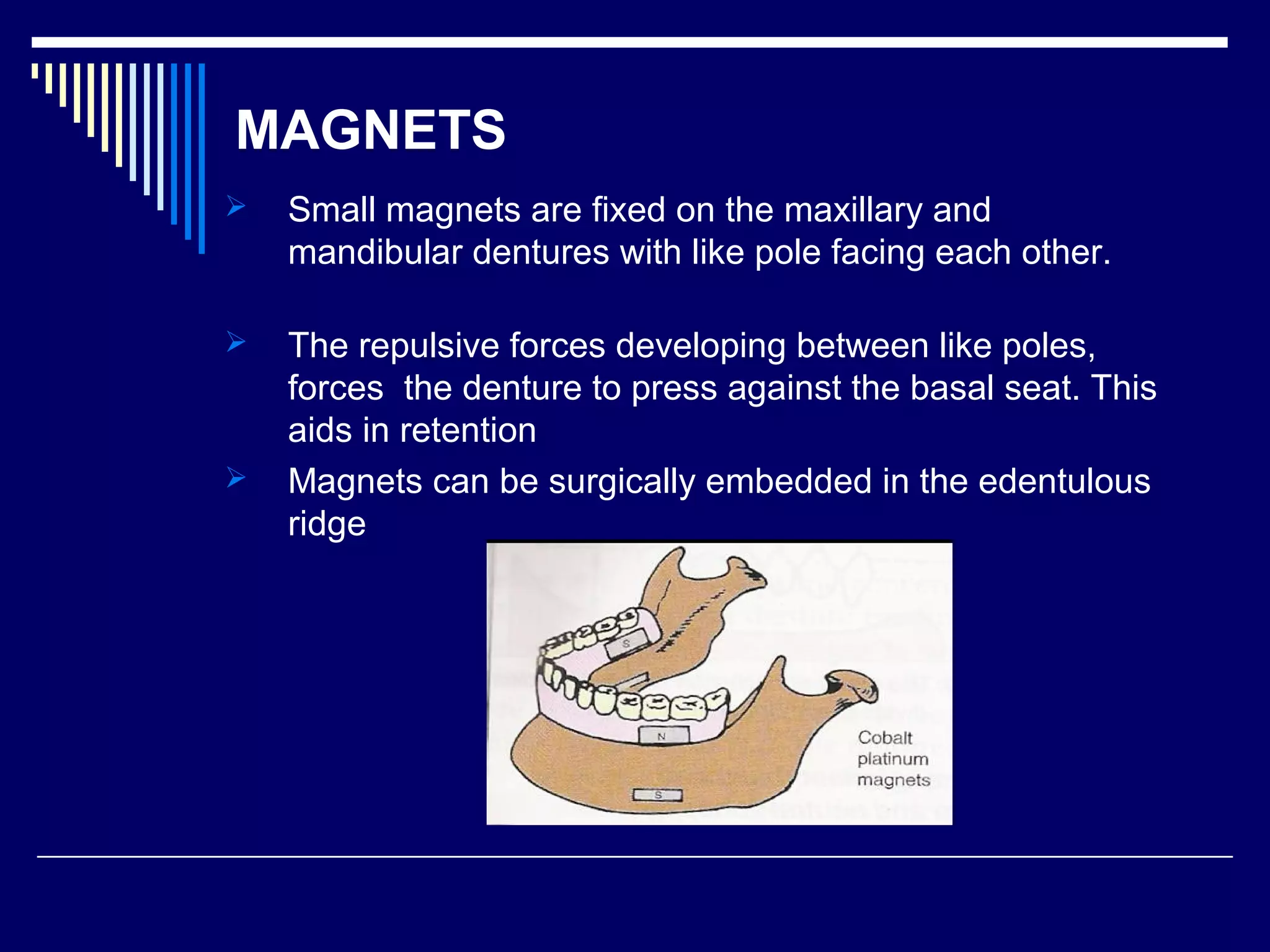 MAGNETS
 Small magnets are fixed on the maxillary and
mandibular dentures with like pole facing each other.
 The repulsive forces developing between like poles,
forces the denture to press against the basal seat. This
aids in retention
 Magnets can be surgically embedded in the edentulous
ridge
 