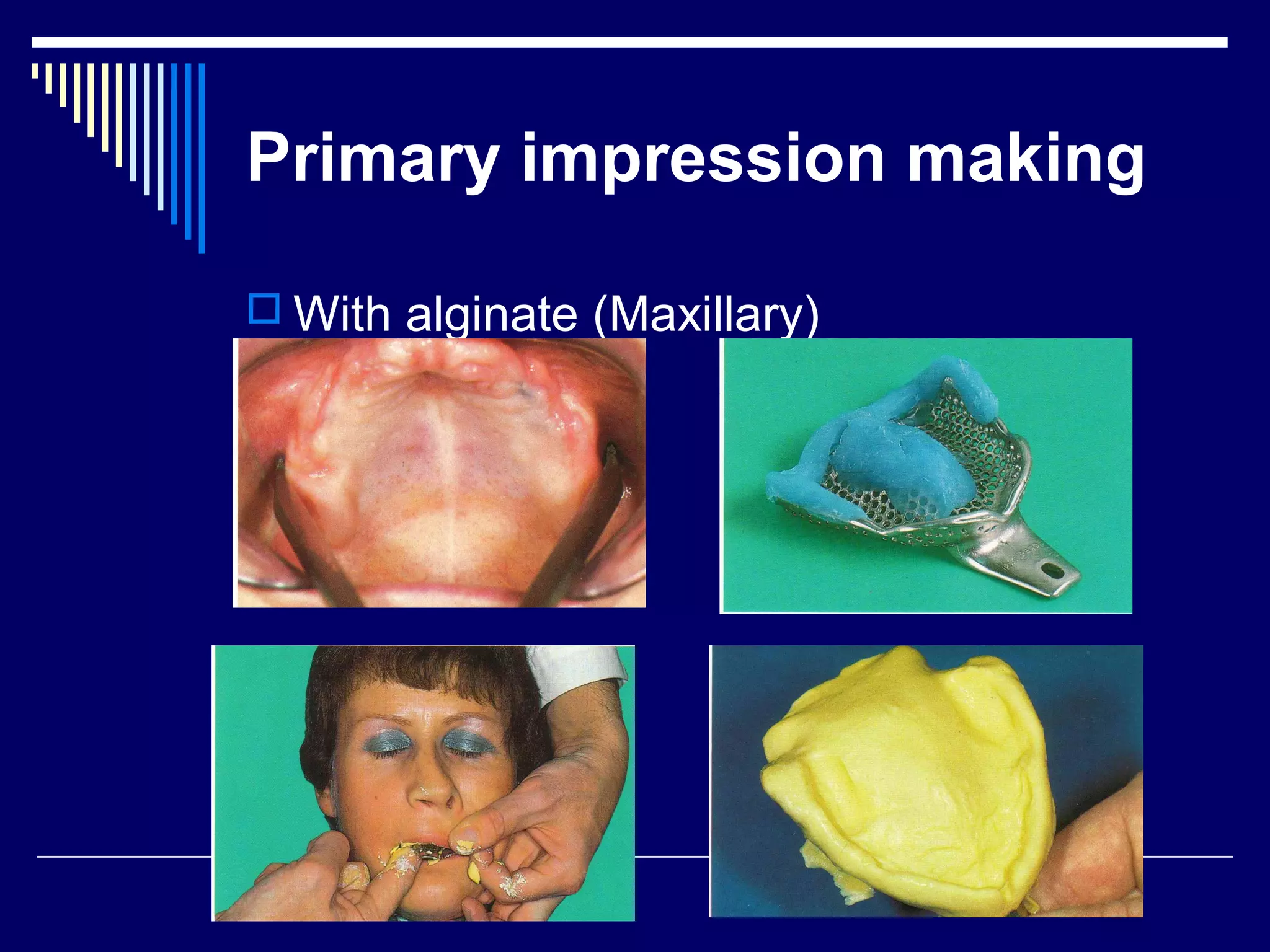Primary impression making
 With alginate (Maxillary)
 