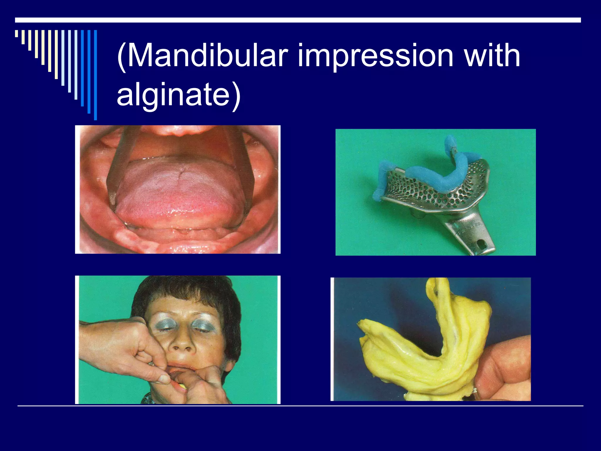 (Mandibular impression with
alginate)
 