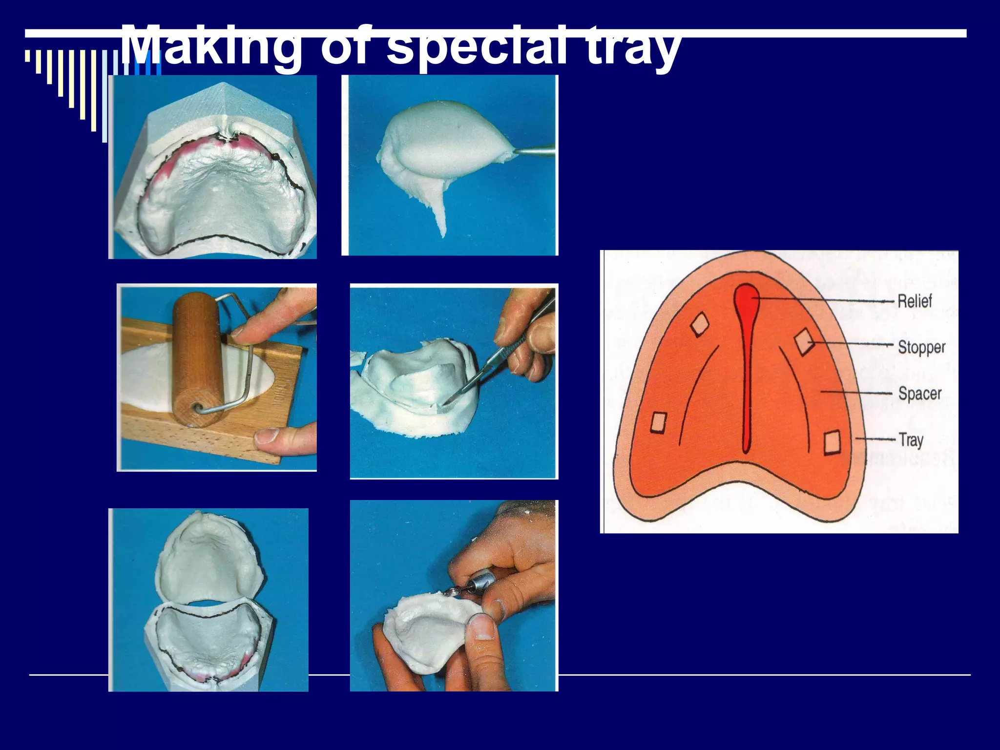 Making of special tray
 