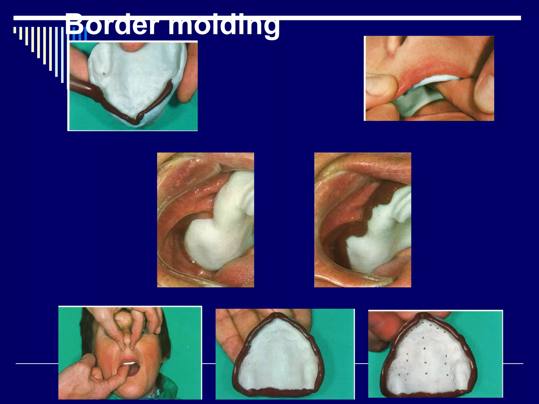Border molding
 