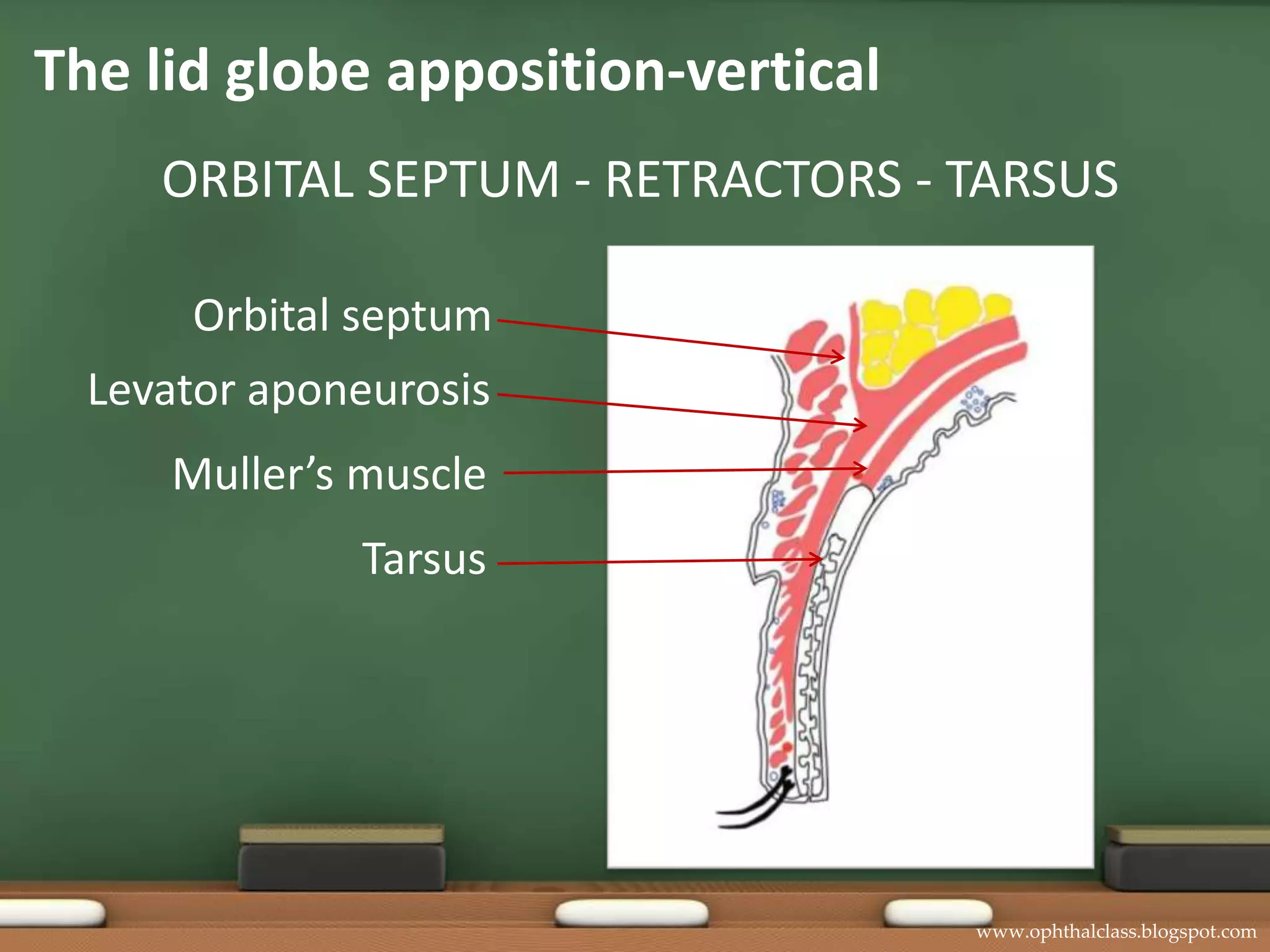 Loss of lid-globe apposition