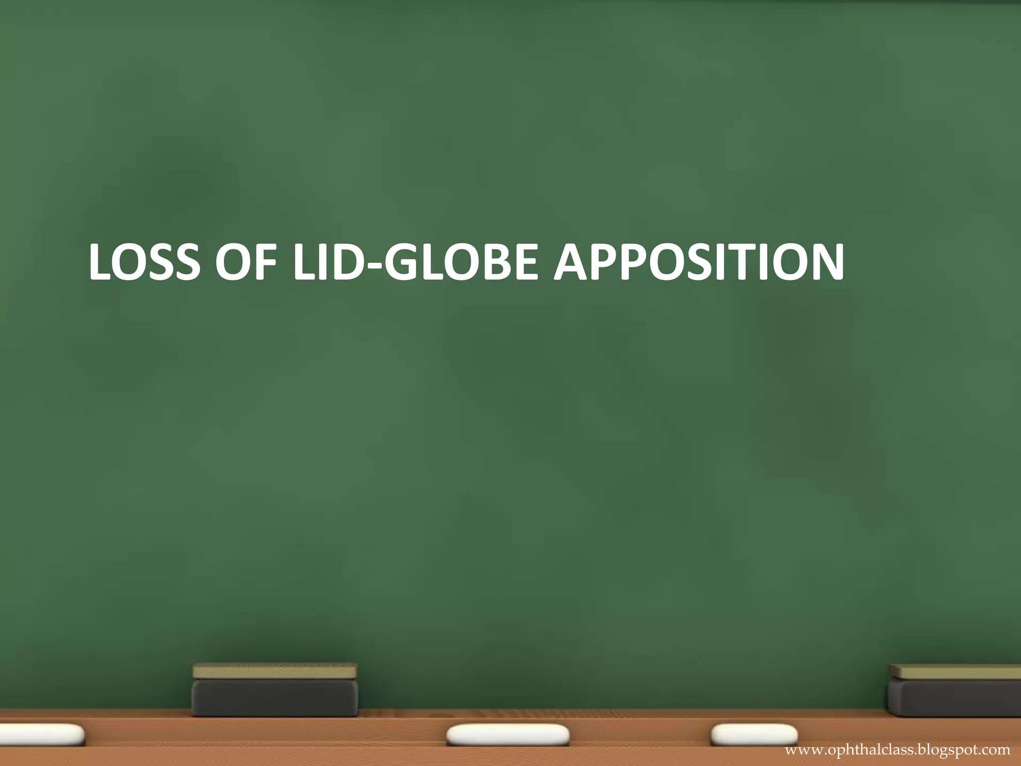 Abnormal lid-globe relationsEctropionEversion of eyelid marginEntropionRolling inwards of eyelid margin