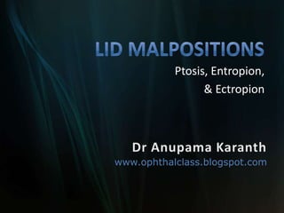 LID MALPOSITIONS Ptosis, Entropion, & Ectropion Dr Anupama Karanth www.ophthalclass.blogspot.com 