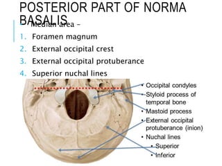 POSTERIOR PART OF NORMA
BASALIS• Median area –
1. Foramen magnum
2. External occipital crest
3. External occipital protuberance
4. Superior nuchal lines
21
 