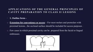 Class 2 cavity amalgam PPTX