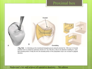 Proximal box
. Studevant’s Art and science of operative dentistry – 7th edition
 