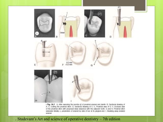 . Studevant’s Art and science of operative dentistry – 7th edition
 