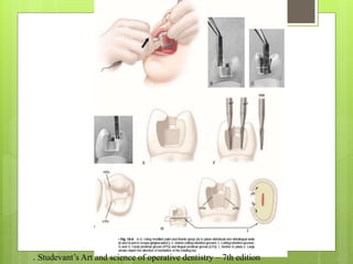 . Studevant’s Art and science of operative dentistry – 7th edition
 
