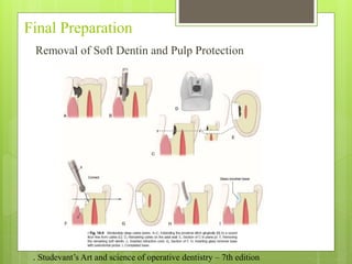 Final Preparation
Removal of Soft Dentin and Pulp Protection
. Studevant’s Art and science of operative dentistry – 7th edition
 
