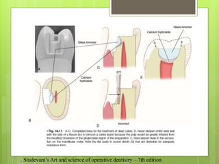 . Studevant’s Art and science of operative dentistry – 7th edition
 