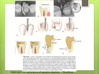 . Studevant’s Art and science of operative dentistry – 7th edition
 