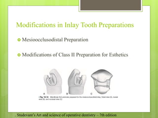 Class 2 Operative class 2 inlay 1.pptx