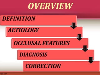 Class 2 treatment in growing and adult patients | PPTX
