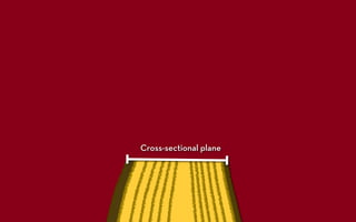 Cross-sectional plane
 