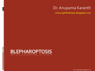 Blepharoptosis Dr. Anupama Karanth www.ophthalclass.blogspot.com 