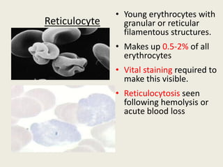 Reticulocyte
• Young erythrocytes with
granular or reticular
filamentous structures.
• Makes up 0.5-2% of all
erythrocytes
• Vital staining required to
make this visible.
• Reticulocytosis seen
following hemolysis or
acute blood loss
 