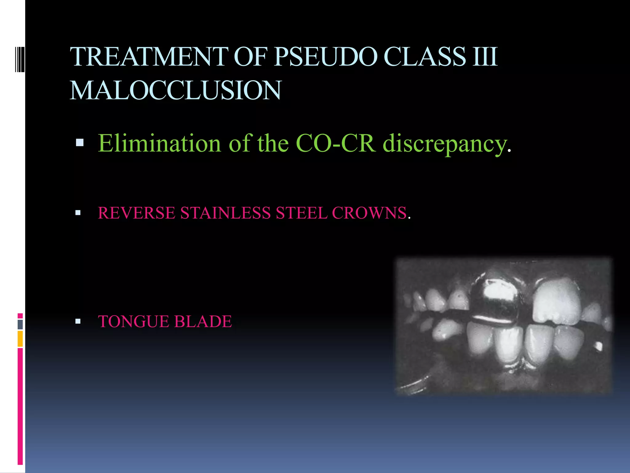 TREATMENT OF PSEUDO CLASS III
MALOCCLUSION
 Elimination of the CO-CR discrepancy.
 REVERSE STAINLESS STEEL CROWNS.
 TONGUE BLADE
 