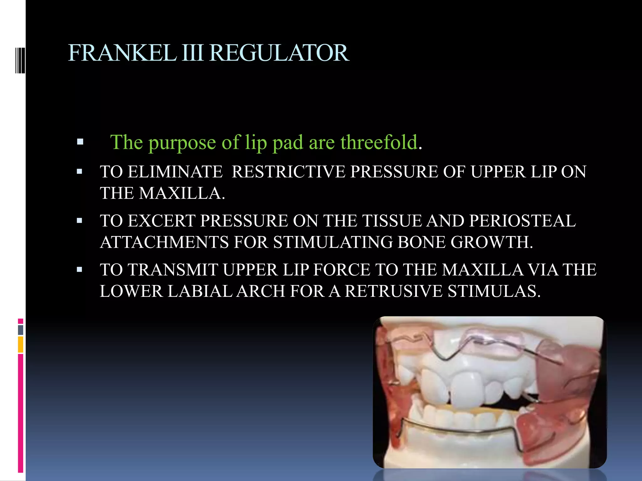 FRANKELIII REGULATOR
 The purpose of lip pad are threefold.
 TO ELIMINATE RESTRICTIVE PRESSURE OF UPPER LIP ON
THE MAXILLA.
 TO EXCERT PRESSURE ON THE TISSUE AND PERIOSTEAL
ATTACHMENTS FOR STIMULATING BONE GROWTH.
 TO TRANSMIT UPPER LIP FORCE TO THE MAXILLA VIA THE
LOWER LABIAL ARCH FOR A RETRUSIVE STIMULAS.
 