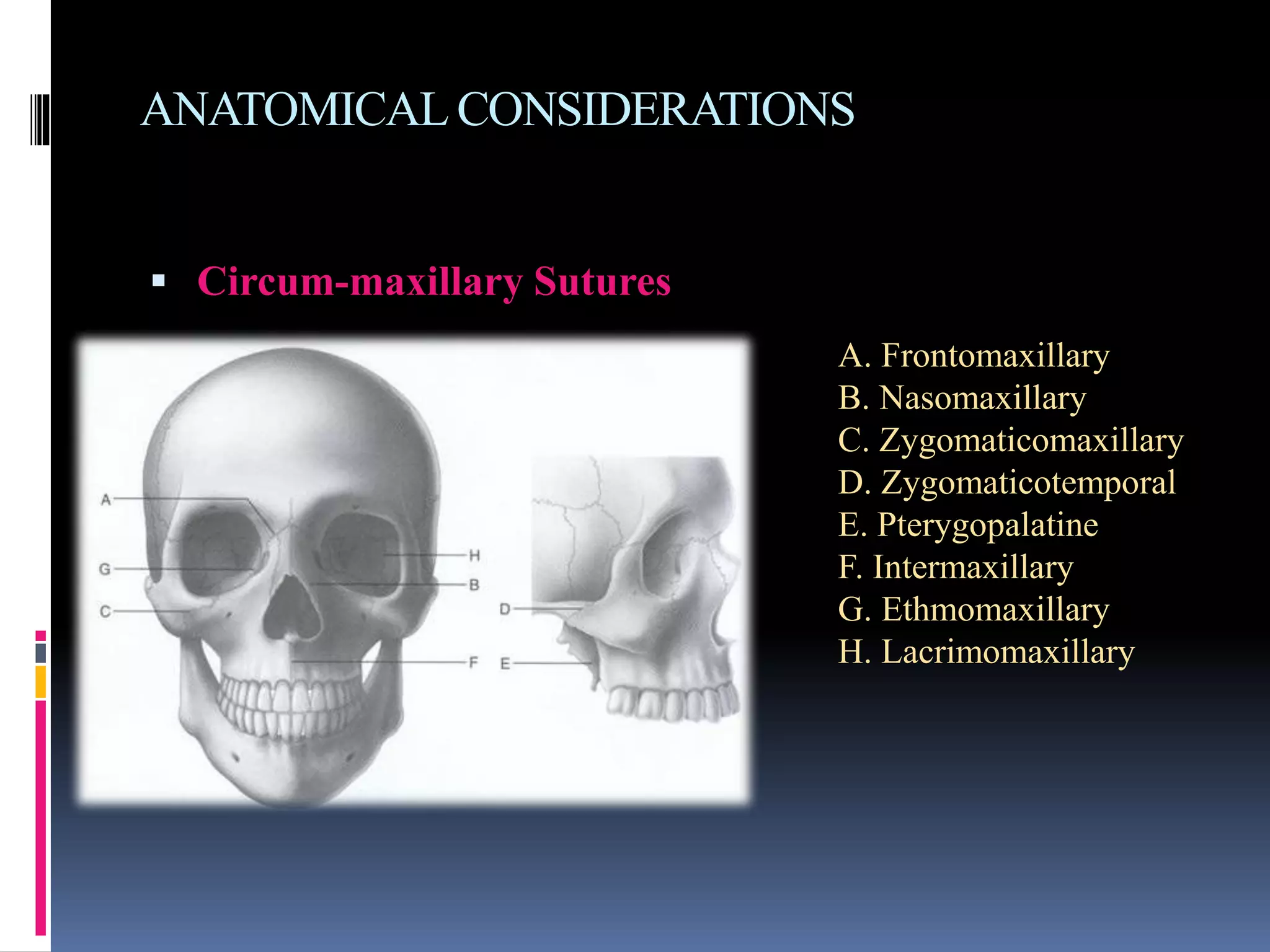 ANATOMICAL CONSIDERATIONS
 Circum-maxillary Sutures
A. Frontomaxillary
B. Nasomaxillary
C. Zygomaticomaxillary
D. Zygomaticotemporal
E. Pterygopalatine
F. Intermaxillary
G. Ethmomaxillary
H. Lacrimomaxillary
 