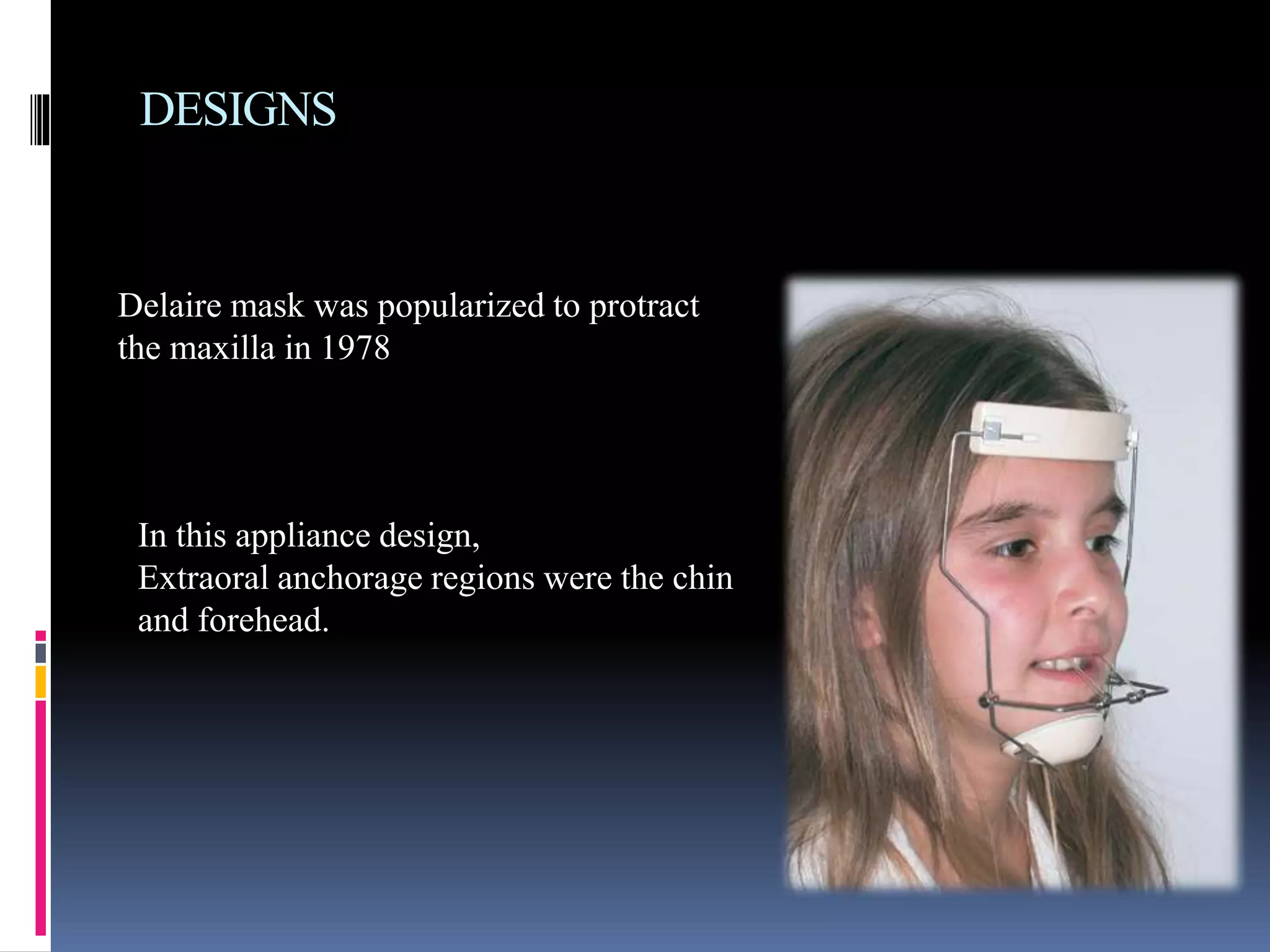 DESIGNS
Delaire mask was popularized to protract
the maxilla in 1978
In this appliance design,
Extraoral anchorage regions were the chin
and forehead.
 