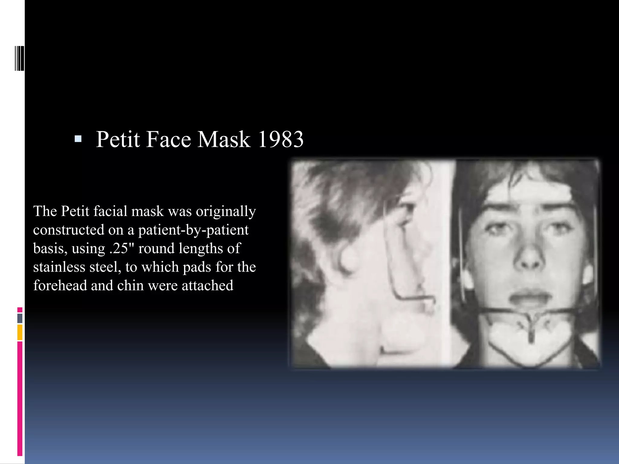  Petit Face Mask 1983
The Petit facial mask was originally
constructed on a patient-by-patient
basis, using .25" round lengths of
stainless steel, to which pads for the
forehead and chin were attached
 