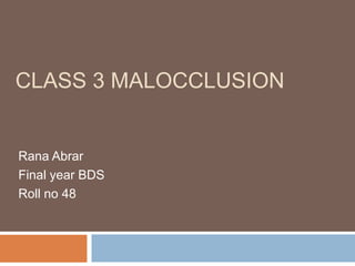 CLASS 3 MALOCCLUSION 
Shahzad Hussain 
Final year BDS 
Roll no 48 
 