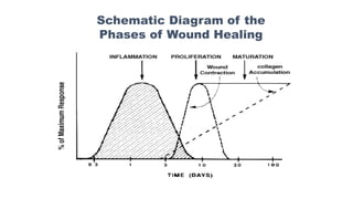 Schematic Diagram of the
Phases of Wound Healing
 
