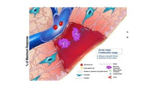 Schematic Diagram of the
Phases of Wound Healing
 