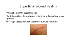 Superficial Wound Healing
• Ulcerations in the superficial skin
• Soft tissues heal themselves over time via inflammatory repair
process
• I.e. stage I pressure ulcer, superficial burn, or contusion
 