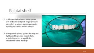 Direct Restorative Management of Ellis Class 2 Dental Fractures Using ...