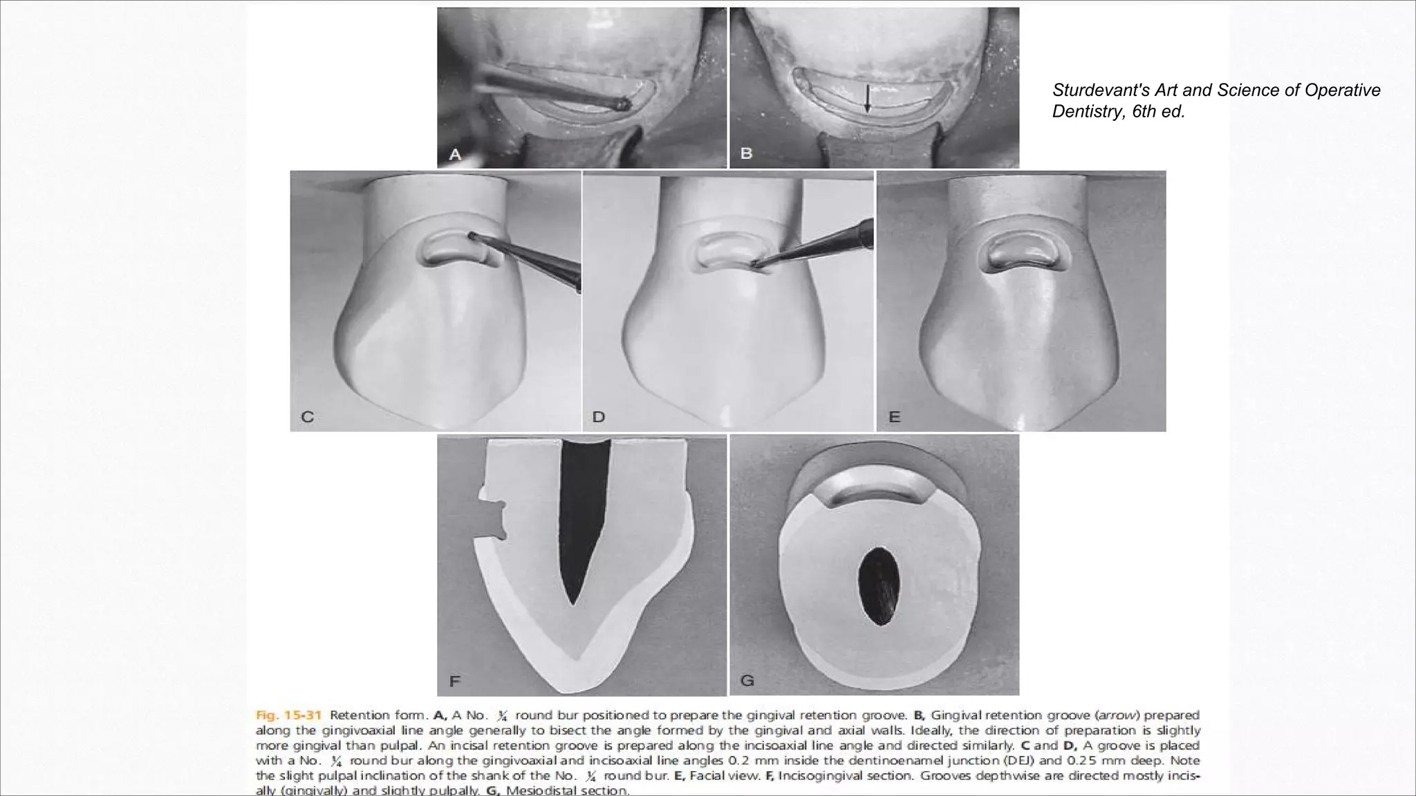 Sturdevant's Art and Science of Operative
Dentistry, 6th ed.
 