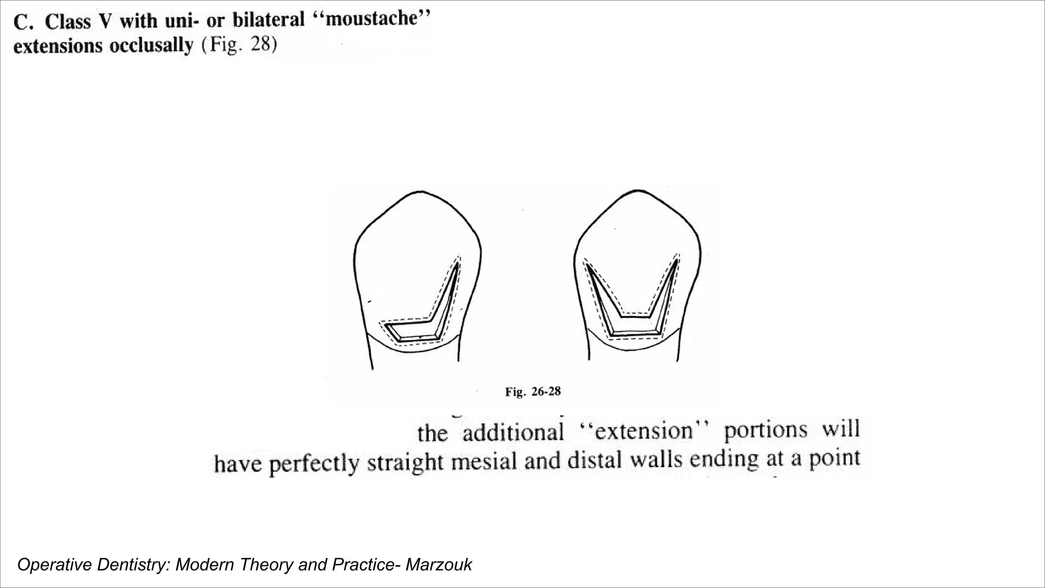 Operative Dentistry: Modern Theory and Practice- Marzouk
 