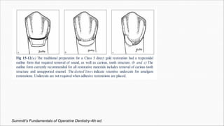 Summitt's Fundamentals of Operative Dentistry-4th ed.
 