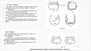 Operative Dentistry: Modern Theory and Practice- Marzouk
 