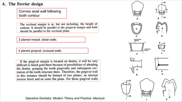 Class 5 cavity designs | PDF | Dental Health | Diseases and Conditions