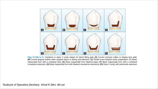 Textbook of Operative Dentistry: Vimal K Sikri, 4th ed.
 