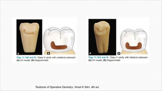Textbook of Operative Dentistry: Vimal K Sikri, 4th ed.
 