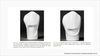 Sturdevant's Art and Science of Operative Dentistry, 6th ed.
 