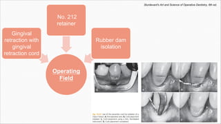Operating
Field
Gingival
retraction with
gingival
retraction cord
No. 212
retainer
Rubber dam
isolation
Sturdevant's Art and Science of Operative Dentistry, 6th ed.
 