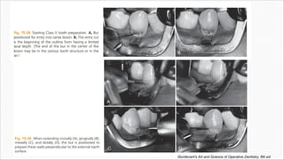 Sturdevant's Art and Science of Operative Dentistry, 6th ed.
 