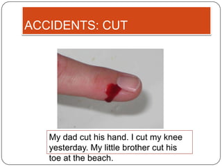 ACCIDENTS: CUT




   My dad cut his hand. I cut my knee
   yesterday. My little brother cut his
   toe at the beach.
 