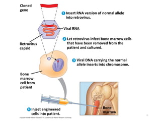 55
Bone
marrow
Cloned
gene
Bone
marrow
cell from
patient
Insert RNA version of normal allele
into retrovirus.
Retrovirus
capsid
Viral RNA
Let retrovirus infect bone marrow cells
that have been removed from the
patient and cultured.
Viral DNA carrying the normal
allele inserts into chromosome.
Inject engineered
cells into patient.
1
2
3
4
 