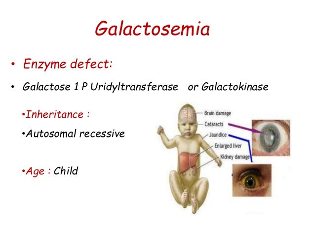 Class 9 galactose metabolism