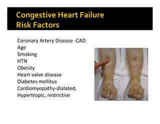 Coronary Artery Disease -CAD
Age
Smoking
HTN
Obesity
Heart valve disease
Diabetes mellitus
Cardiomyopathy-dialated,
Hypert...