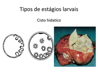 Tipos de estágios larvais
Cisto hidatico
 