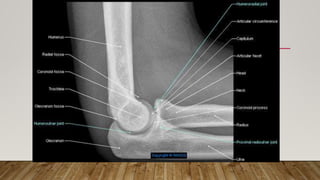 NORMAL UPPER LIMB X-RAY SET
 