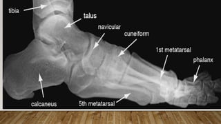 HOW PATHOLOGIES LOOK IN X-RAYS
 