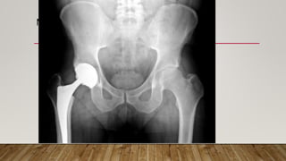 METAL DETECTOR………..
 